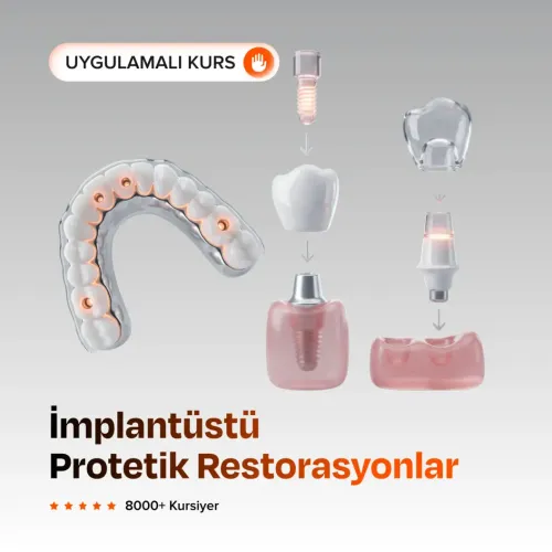 İmplantüstü Protetik Restorasyonlar