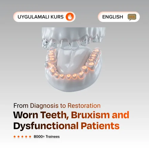 Worn Teeth, Bruxism and Dysfunctional Patients: From Diagnosis to Restoration