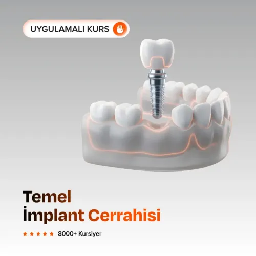 Temel İmplant Cerrahisi