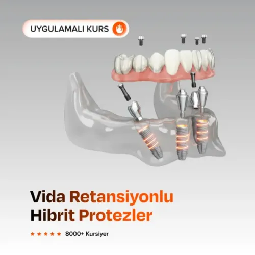 Vida Retansiyonlu Restorasyonlar & Hibrit Protezler