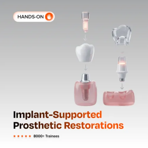 Implant Supported Prosthetic Restorations