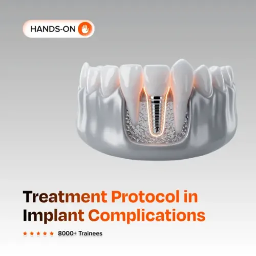 Treatment Protocol in Implant Complications