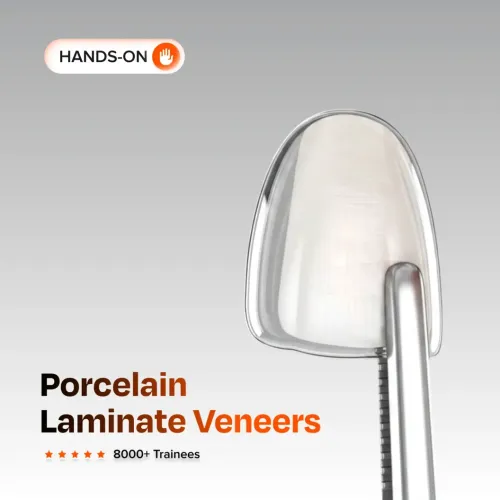 Porcelain Laminate Veneers