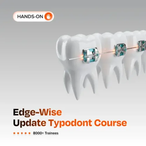 Edge-Wise Update Typodont Course: Advanced Bending Techniques