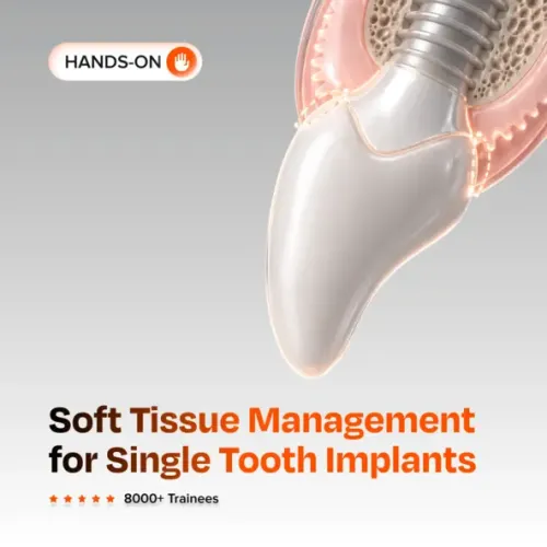 Soft Tissue Management for Single Tooth Implants