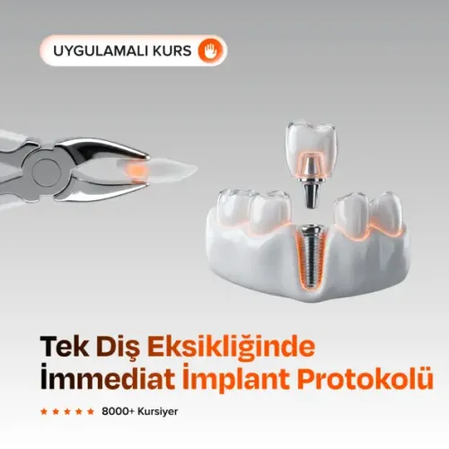 Estetik Bölge Tek Diş Eksikliğinde Çift İmmediat İmplant Protokolü