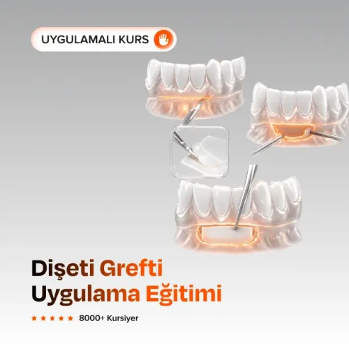 Dişeti Grefti Uygulama Eğitimi