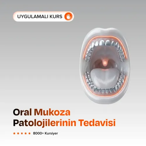 Oral Mukoza Patolojilerinin Tedavisi
