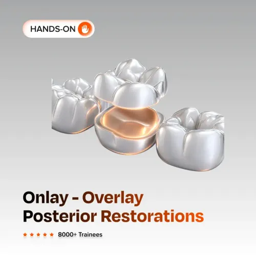 Onlay - Overlay Posterior Restorations