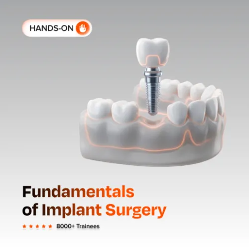 Fundamentals of Implant Surgery