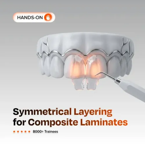 Symmetrical Layering For Composite Laminates