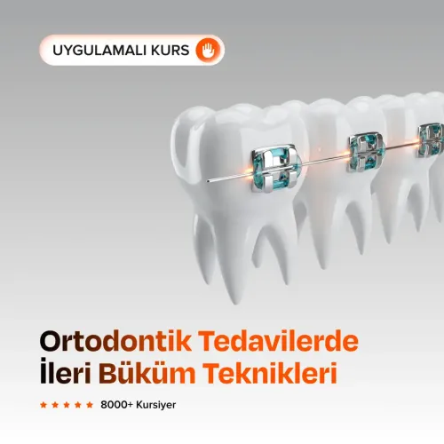 Ortodontik Tedavilerde İleri Büküm Teknikleri
