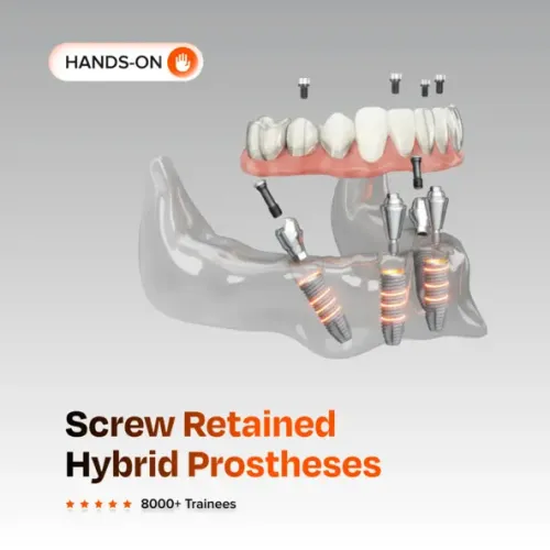 Screw Retained Hybrid Prostheses