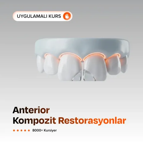 Anterior Kompozit Restorasyonlar