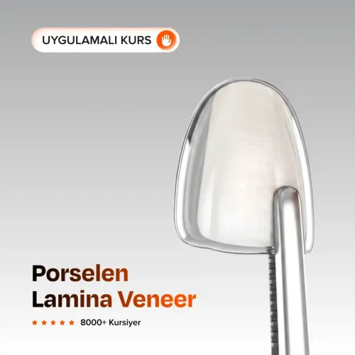 Porselen Lamina Veneer