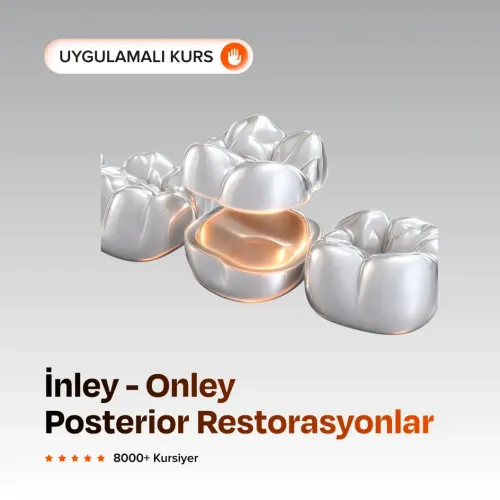 İnley - Onley  Posterior Restorasyonlar